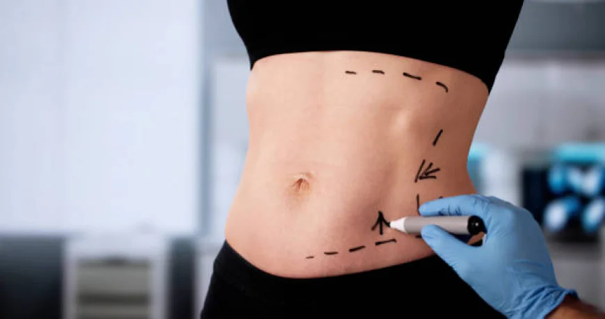 What Factors Affect the Success of a Tummy Tuck