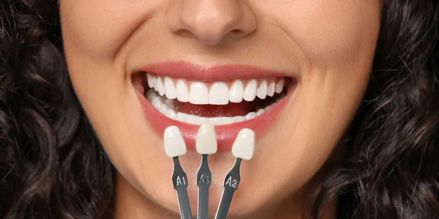 Transform Your Smile Naturally with Dental Veneers