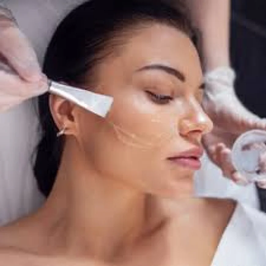 Why Chemical Peels in Dubai Are a Popular Choice for Skin Rejuvenation