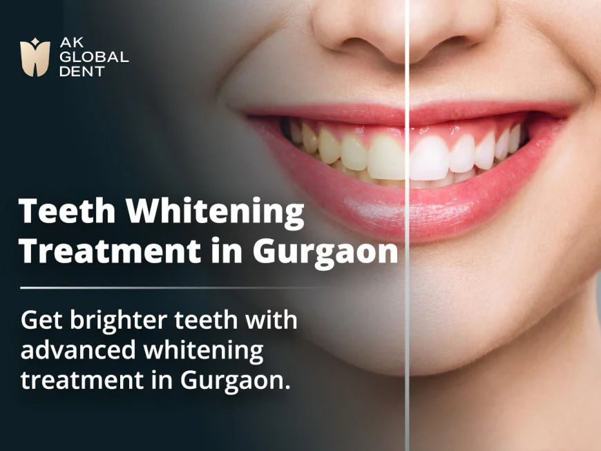Achieve a Brighter Smile with Professional Teeth Whitening Treatment in Gurgaon