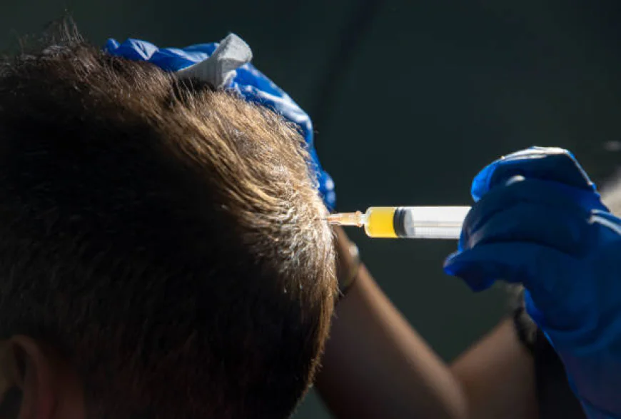 PRP Hair Therapy in Islamabad: A Natural Solution for Hair Restoration