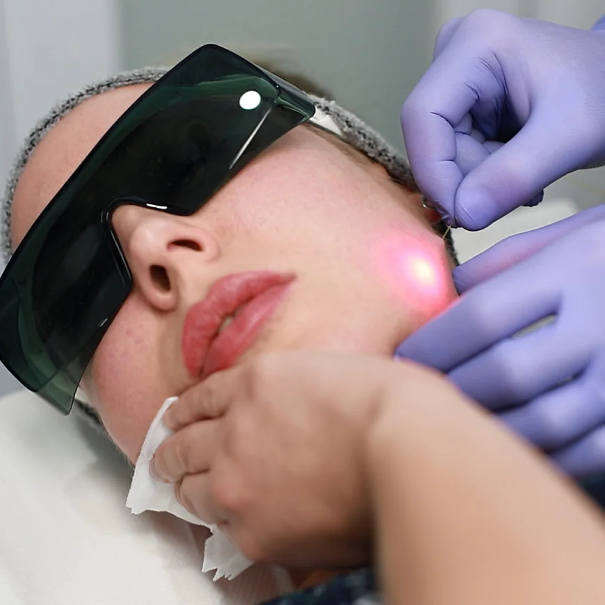 Can Endolift Treatment Remove Stubborn Double Chin Fat Fast