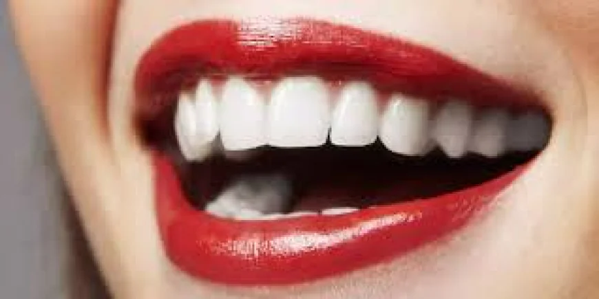 How Does Hollywood Smile Design Work?