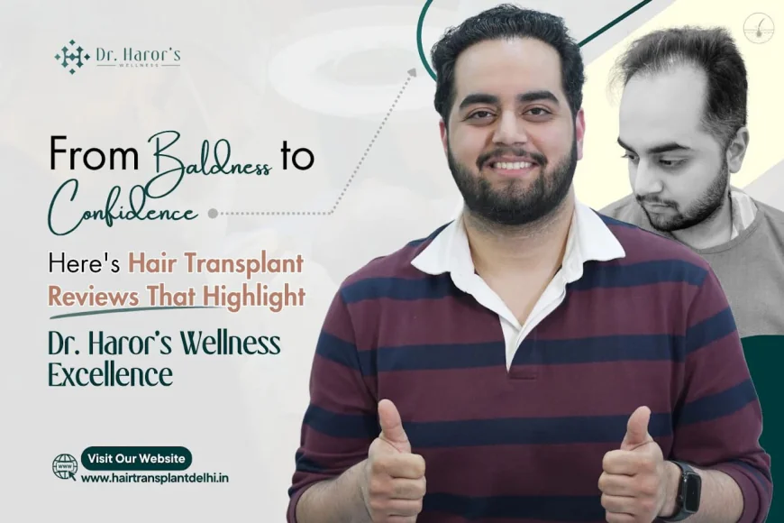 From Baldness to Confidence: Here's Hair Transplant Reviews That Highlight Dr. Haror's Wellness Excellence