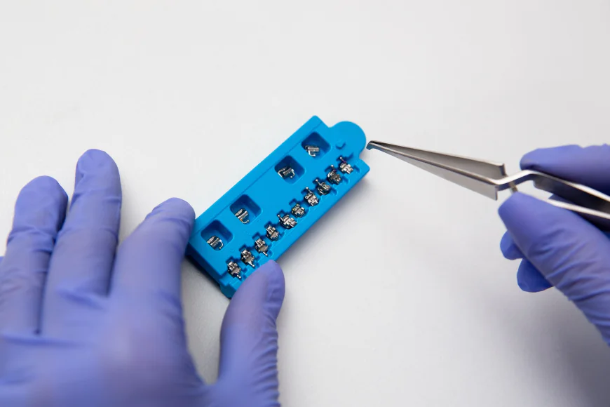 Efficient Smile Correction: Understanding Self-Locking Braces