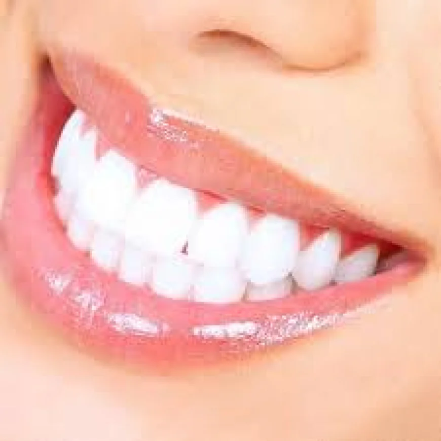 Zoom Teeth Whitening in Dubai – Complete Guide to a Brighter Smile