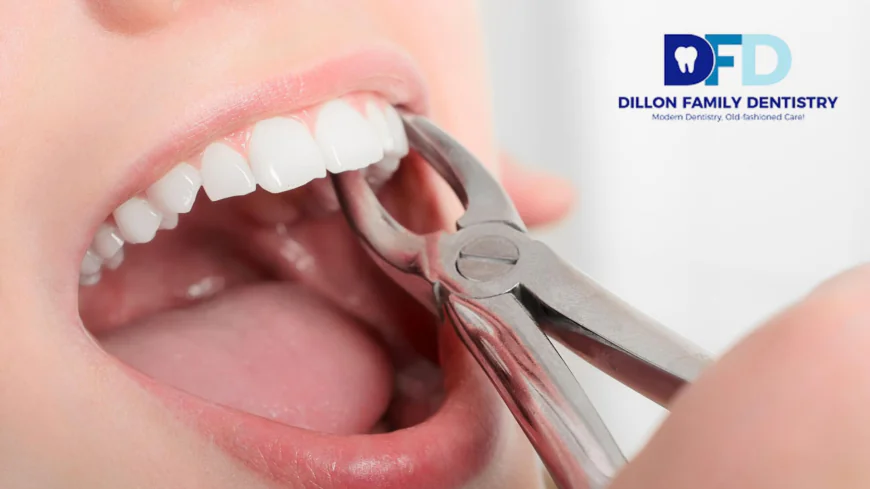 How Painful Is a Tooth Extraction? Bryn Mawr Dentist Guide