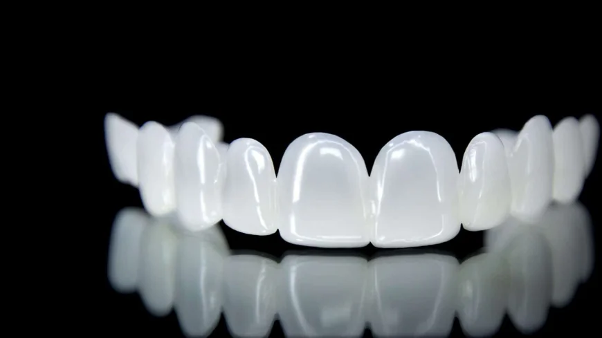 Veneers Dubai: Improve Dental Confidence Fast