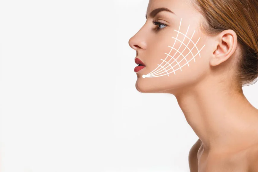 Does a Thread Lift Assist in Reducing Wrinkles?
