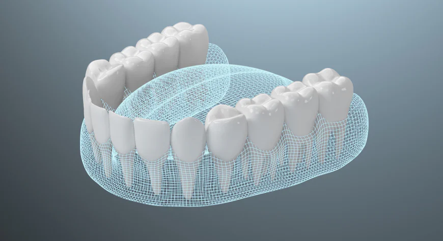 The Role of Full Mouth Restoration in Restoring Function and Confidence