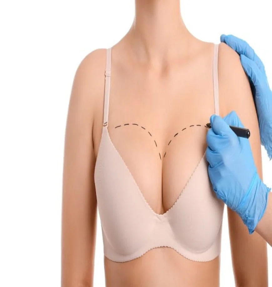 Who Is a Good Candidate for Breast Lift Surgery?
