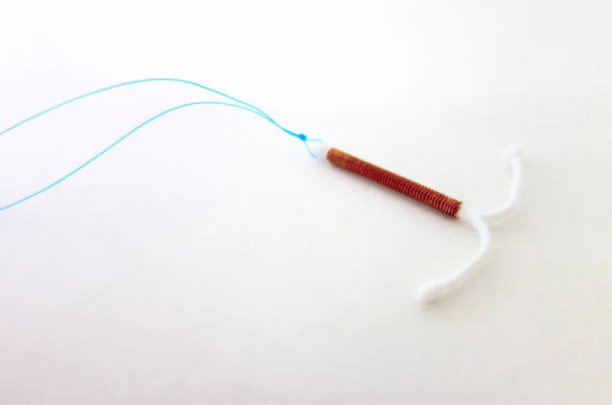 Does IUD for Contraception Require Regular Maintenance