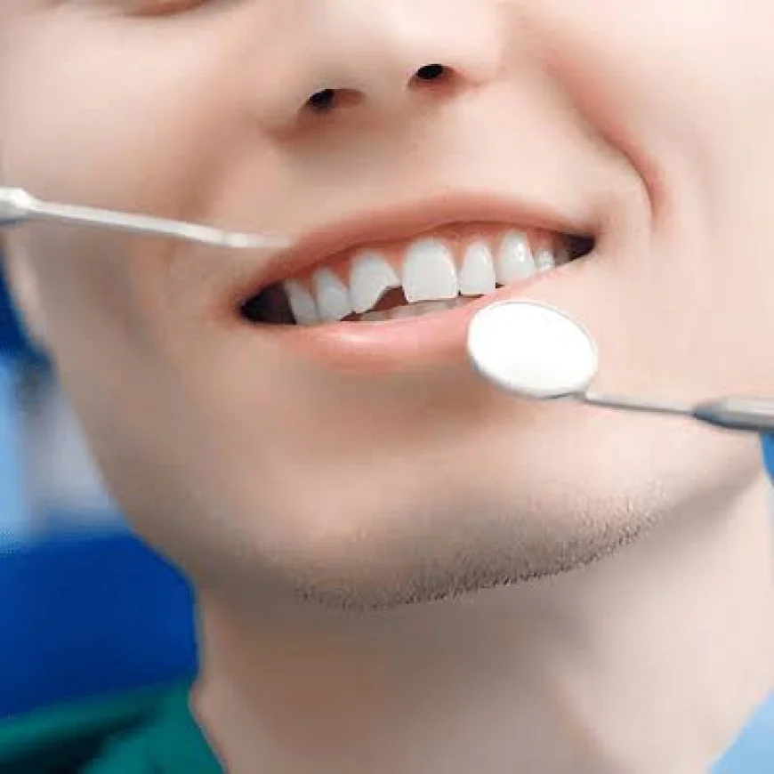 How Treatment of Fractured Teeth in Dubai Can Protect Your Oral Health