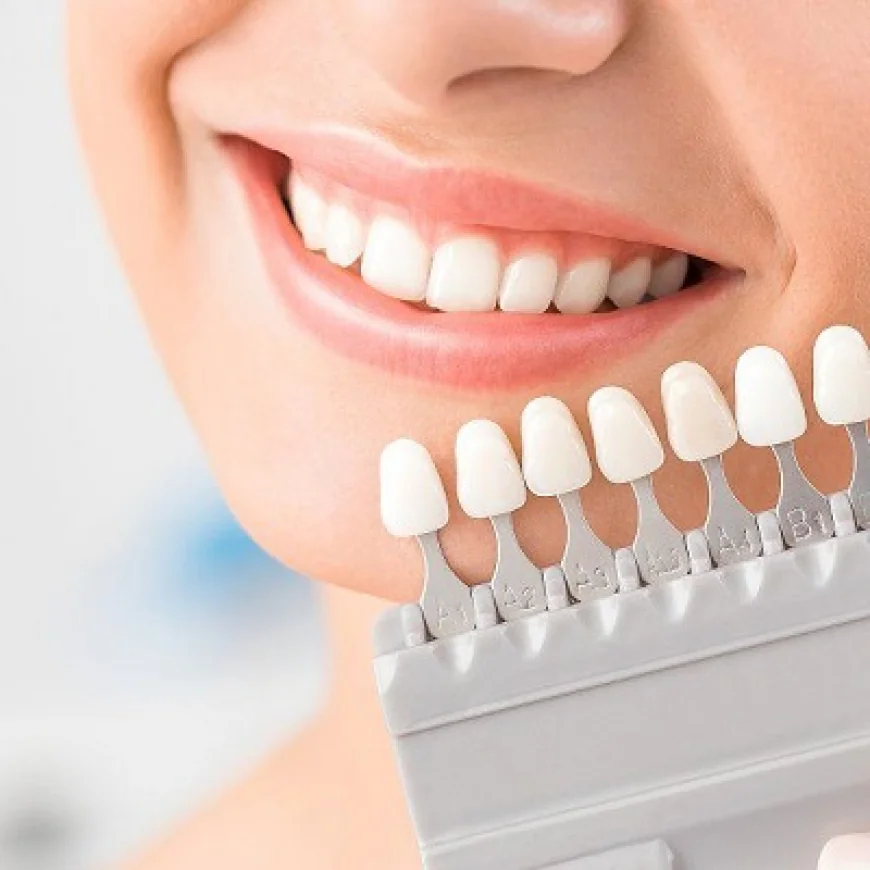 Everything You Need to Know About Zoom Teeth Whitening in Dubai