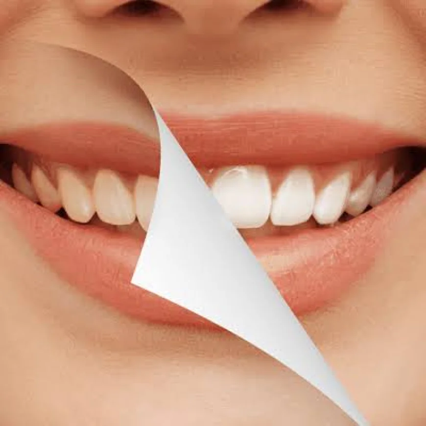 Why Choose Zirconia Crowns in Dubai for Stronger and More Attractive Teeth