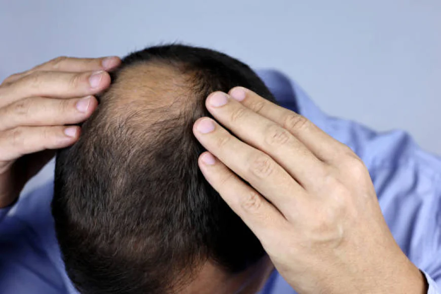 Can GFC Treatment for Hair Restore Thinning Hair