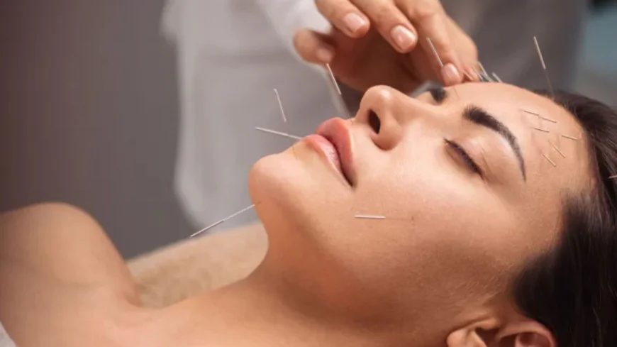 Reduce Wrinkles Without Botox: Try Cosmetic Acupuncture