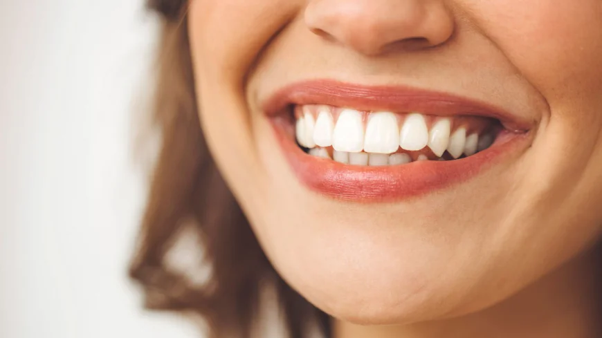 Teeth Whitening Dubai Best Whitening Techniques