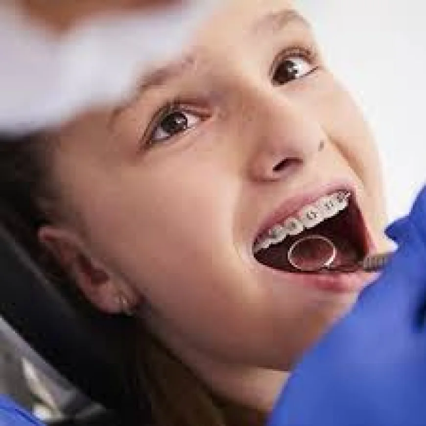 Clear Aligners vs Braces: Choosing Orthodontics in Dubai for Your Smile