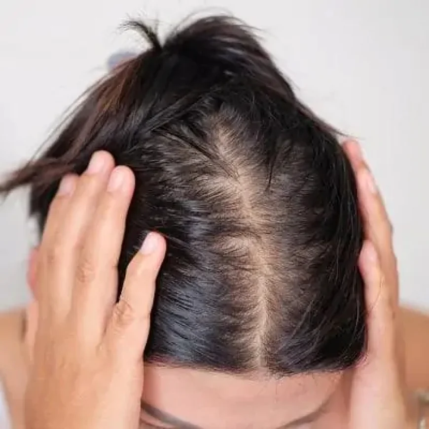 When Is the Right Time to Consider a Female Hair Transplant?