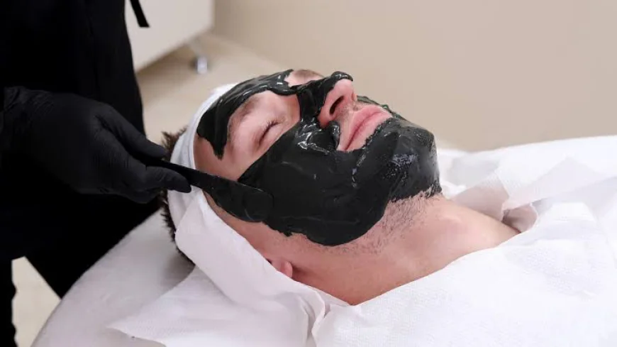 Laser Carbon Peel Treatment for Fast Facial Brightening