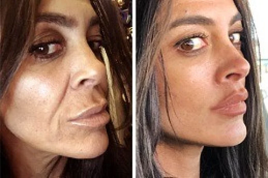 What Makes the Best Plastic Surgeon in Dubai Stand Out in Aesthetic Medicine