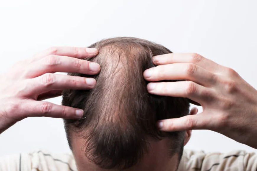 Can Hair Loss Treatment Restore Lost Hair Naturally