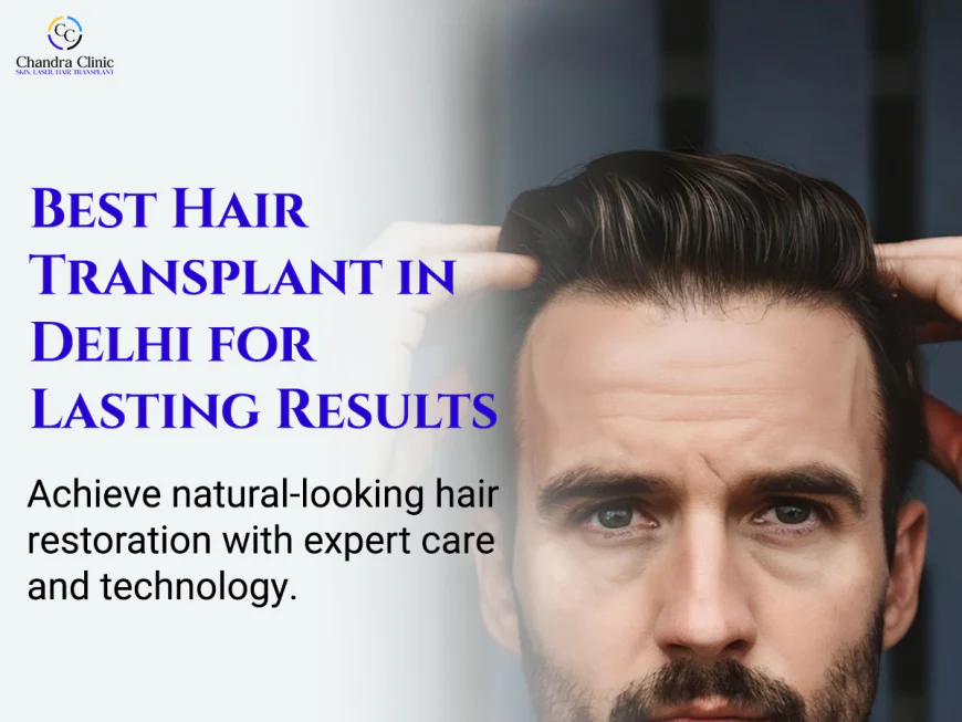 Why More People in Delhi Are Choosing Hair Transplant Surgery Over Other Treatments