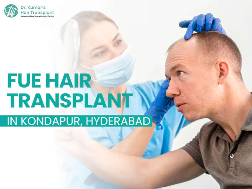 Why More People in Hyderabad Are Choosing FUE Hair Transplant — And Where to Get It Done Right