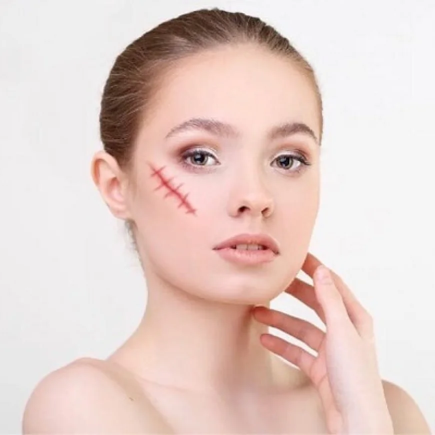 Who Is the Best Candidate for Facial Scar Revision Treatment?