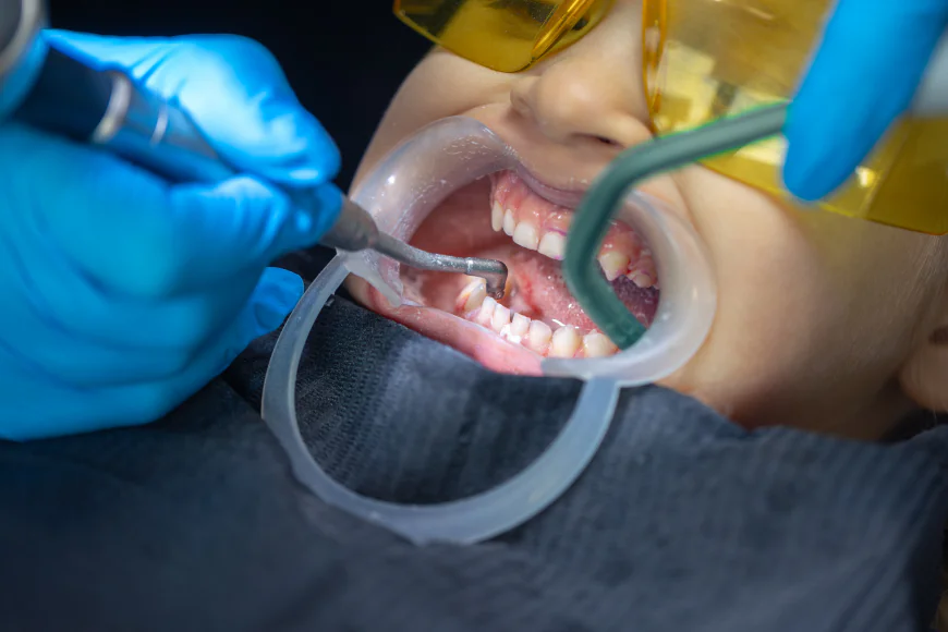 Tooth Extraction Healing Stages Pictures: A Day-by-Day Recovery Timeline You Need to See