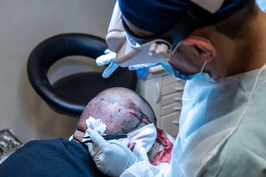 Finding Professional Help for Chicago Hair Restoration