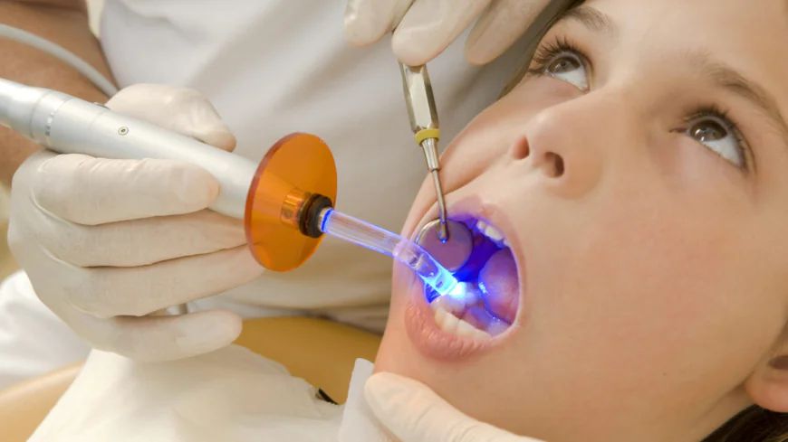 Dental Tooth Filling vs Other Restorative Treatments