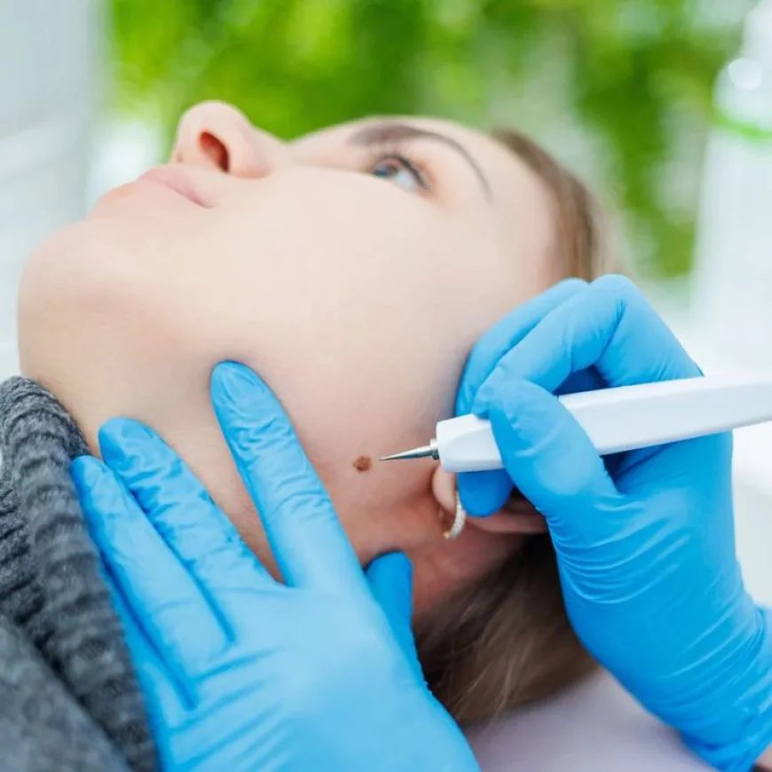 Mole Removal in Dubai: Trusted Techniques