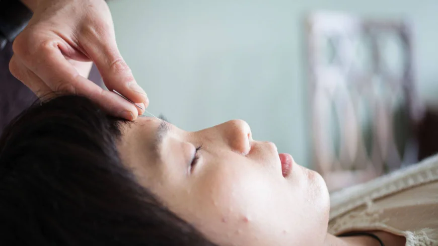 Oakland Acupuncture Clinic: Your First Facial Session