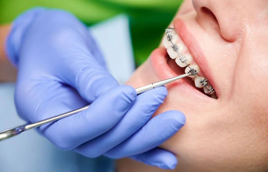 Transform Your Smile with Complete Dental: Your Trusted Orthodontist and Dental Implant Experts in Houston, TX