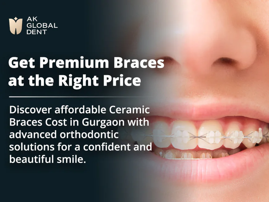 Ceramic Braces in Gurgaon: Your Complete Guide to Affordable Orthodontic Treatment
