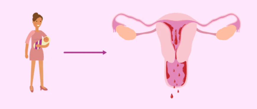 First Period After C-Section: What to Expect, Symptoms & Recovery