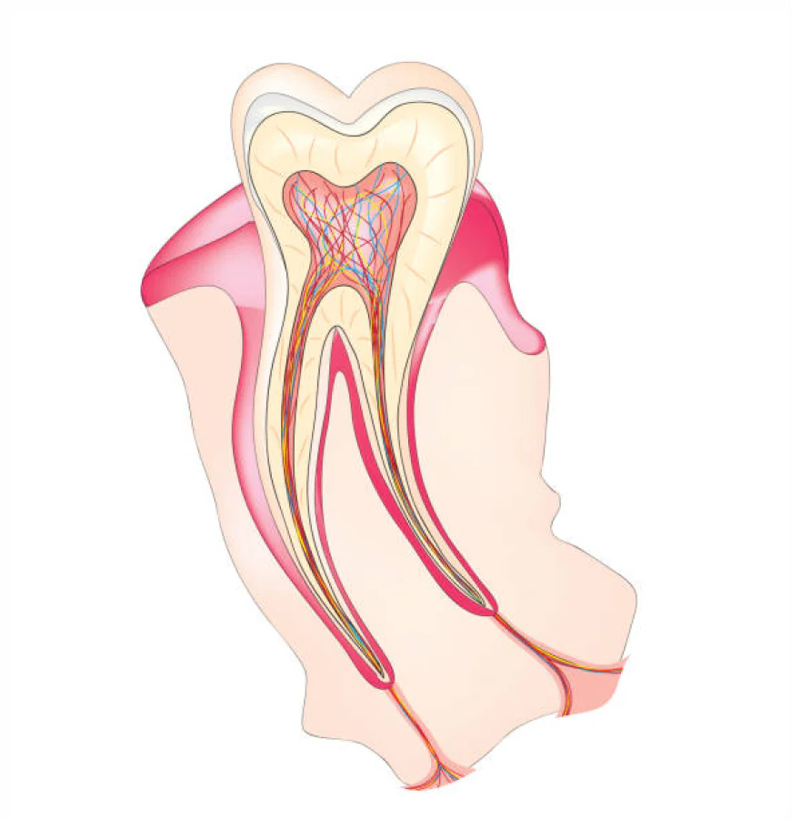 Protect Your Smile with Root Canal Treatment in Islamabad Pakistan
