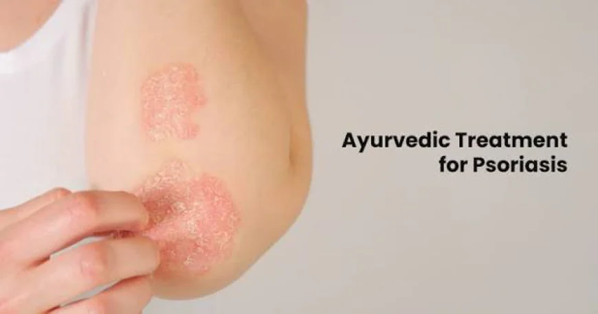 Ayurvedic Treatment for Psoriasis (Ekakushtha / Kitibha)