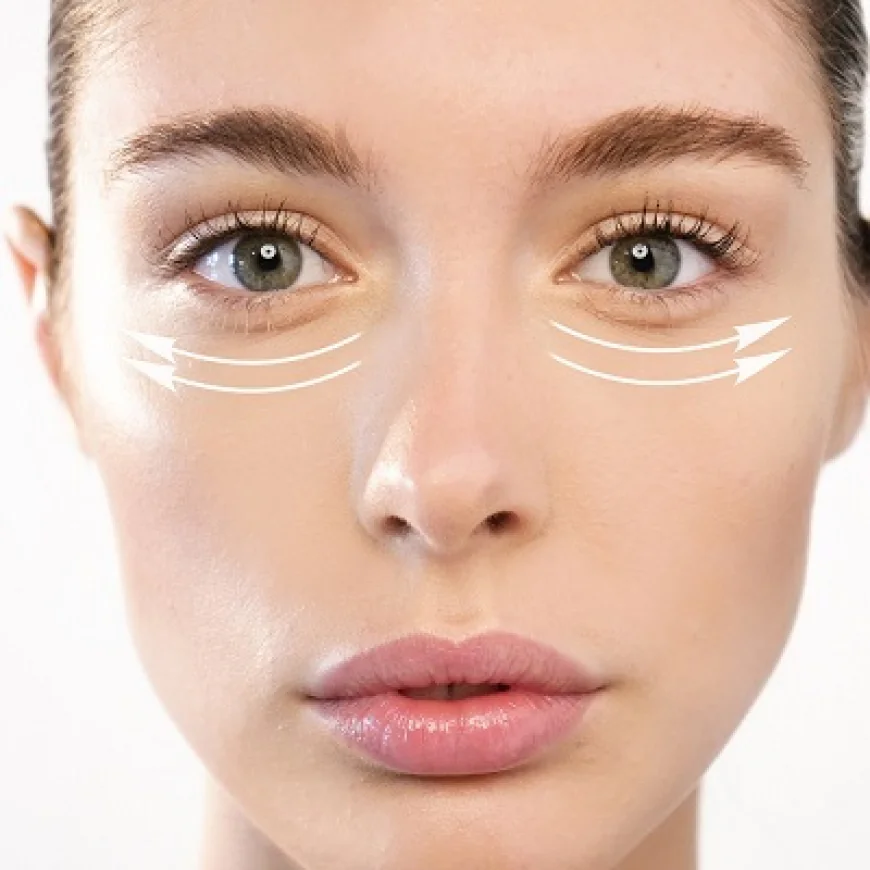 What Is Eye Bag Removal Treatment and How Is It Performed?
