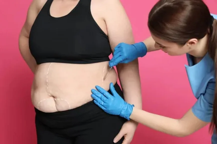 Bariatric Surgery Success Stories: Real Results and Expectations