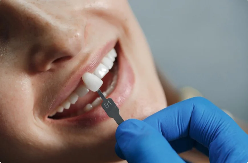 Dental Implants in Kinston, NC: Everything You Need to Know Before Replacing Missing Teeth