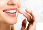 Best Dental Veneers in Dubai for Stained Teeth