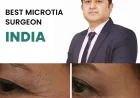 Choosing the Right Path for Microtia Ear Surgery in India