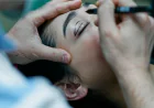 Eyelid Surgery in Islamabad for Maintaining Natural Eye Expressions