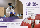 Dental Implant in Palava: Common Myths You Should Stop Believing