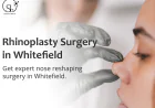 Why is Liquid Rhinoplasty Trending Nowadays?