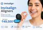 Invisalign Cost in Pune | A Complete Guide to Clear Aligner Treatment