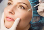 Cosmetic Surgery for Acne Scars in Indore
